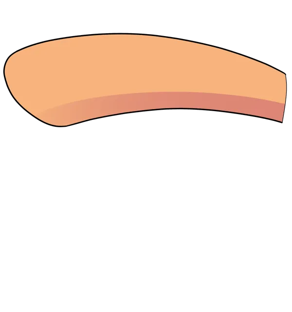 Mimosa Hoof
